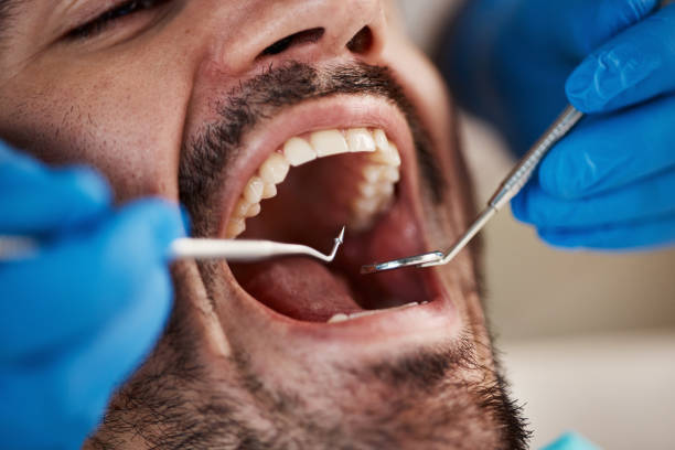 Professional Emergency Dentist in NH